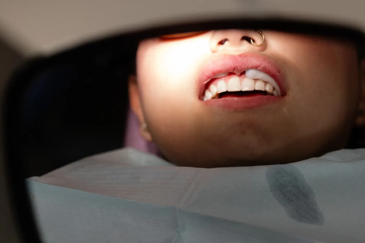 What Counts as a Dental Emergency?